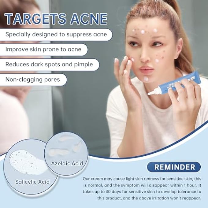 mopayzer AZELAIC ACID 14% ACNE CREAM FOR REDNESS RELIEF, DARK SPOTS, FACIAL SERUM WITH NIACINAMIDE & VITAMIN C PREVENT ACNE BREAKOUTS, AZELAIC ACID SERUM FOR BALANCE EXCESS SEBUM & SOOTHE IRRITATION, 1 OZ. - Image 4